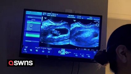 Moment couple found out they were expecting twins - for the second time