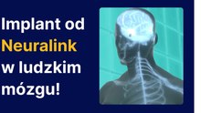 Implant od Neuralink w ludzkim mózgu!