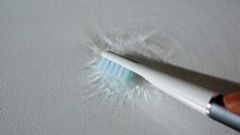 칫솔진동[1]
