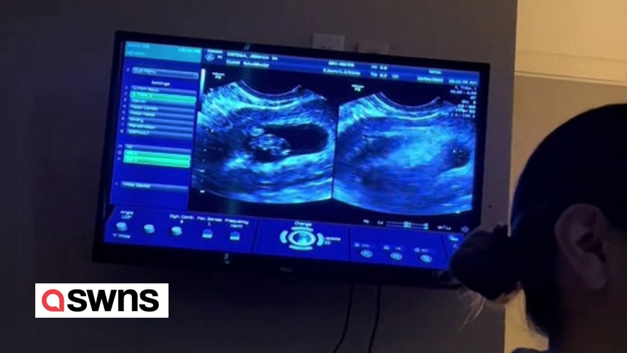 Moment couple found out they were expecting twins - for the second time