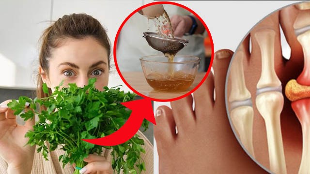 Uric Acid Ka Desi Ilaj | Dhaniya Patta Uric Acid Home Remedy | यूरिक एसिड का देसी इलाज | Boldsky
