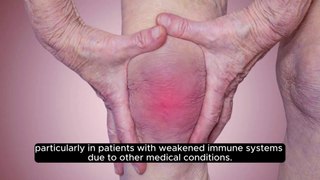 How does arthritis affect the bones