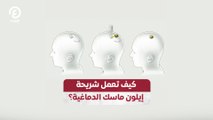 كيف تعمل شريحة إيلون ماسك الدماغية؟