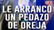 Imágenes sensibles: se enojó con su novia, la mordió y le arrancó un pedazo de oreja