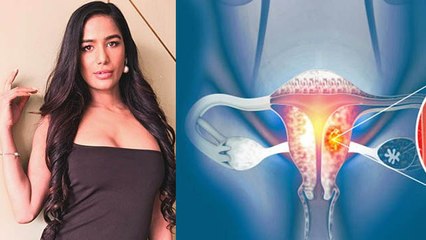 Video herunterladen: Poonam Pandey 32 Age Demise Reason Reveal, Cervical Cancer की Last Stage...| Boldsky