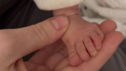Newborn baby has finger-like long toes *Insanely Rare Happening*