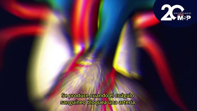 ¿Cómo funcionan los 2 principales tipos de trombosis? - #ExclusivoMSP