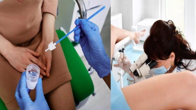 Cervical Cancer Ka Test Kese Hota Hai|Pap Smear Test Kab Karna Chahiye|Boldsky