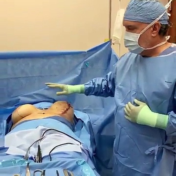 Breast Revision in Oahu Hawaii