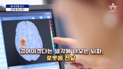 [세계를 보다]‘뇌 안에 칩’ 심어 컴퓨터와 소통 경쟁