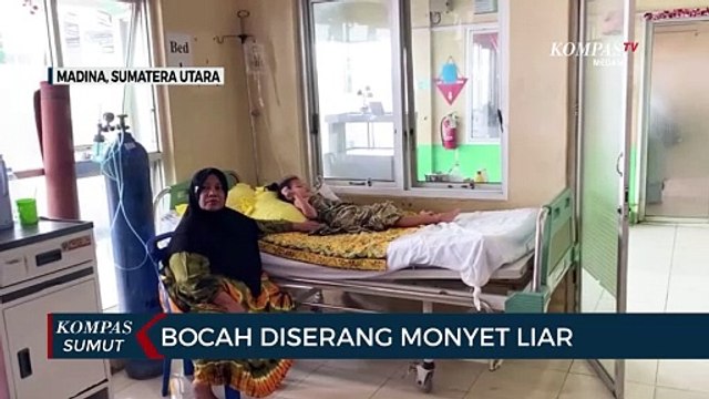 Bocah di Kabupaten Mandailing Natal Diserang Kawanan Monyet Liar