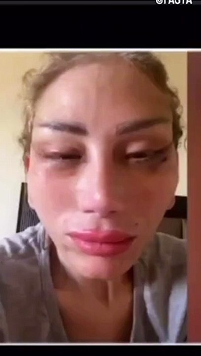 تشوه وجه ريهام سعيد بعد خضوعها للتجميل عند دكتور تجميل مشهور