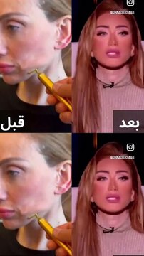 الدكتور نادر صعب يرد بالصوت والصورة