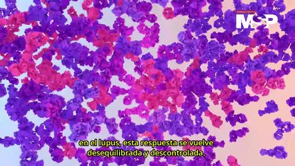 ¿Qué es el lupus eritematoso sistémico y cómo afecta al organismo? - #EspecialMSP