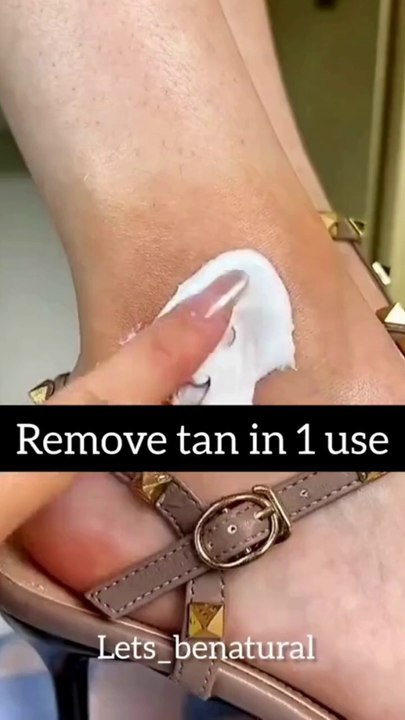 Lighten Dark Knuckles Naturally with  Home Remedies, Learn how to get Whiten, Knees, Elbow, Ankle Tips,