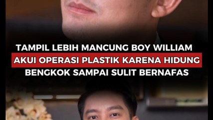 Tampil Lebih Mancung Boy William Akui Operasi Plastik Karena Hidung Bengkok Sampai