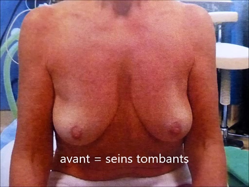 chirurgie esthétique