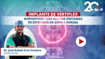 Implante de vertiflex: dispositivo para aliviar síntomas de estenosis en espina dorsal