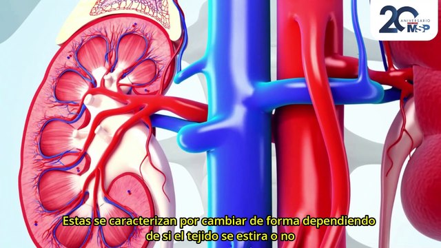 ¿Cuáles son los 3 tipos principales del cáncer de riñón? - #ExclusivoMSP