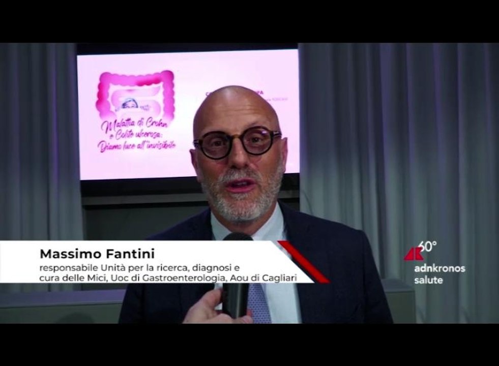 Malattia di Crohn e colite ulcerosa, Fantini ‘G...
