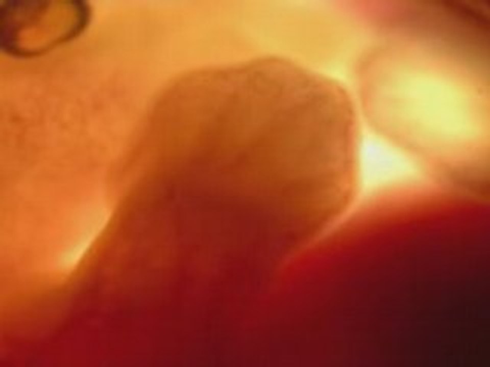 Du baiser au bebe