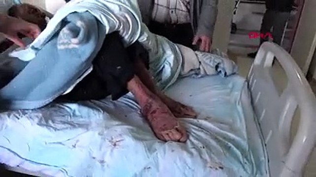 Milyonda 2 görülen hastalık onu buldu! 1 yılda tanınmaz hale geldi