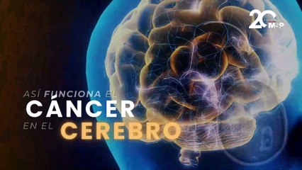 ¿Cómo funciona el cáncer cerebral? - #EspecialMSP