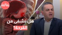 متى تحدث قرحة المعدة؟ وهل يمكن الشفاء منها نهائيًا؟