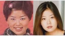 Korean Plastic Surgery Or Cosmetic Surgery