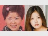 Korean Plastic Surgery Or Cosmetic Surgery