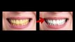 Easy Way To Clean Yellow Teeth In Photoshop 2024 | Easy Teeth Whitening Photoshop Tutorial