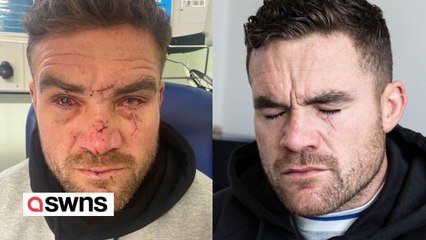 Dad blinded after attack on night out calls for glass ban in bars