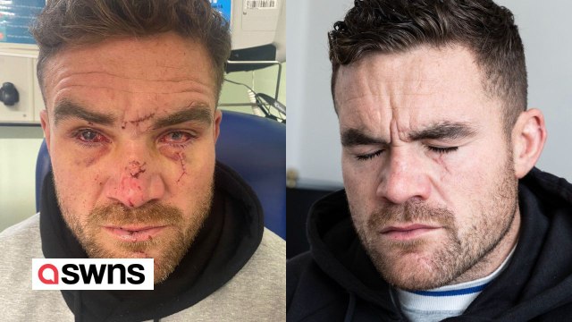 Dad blinded after attack on night out calls for glass ban in bars