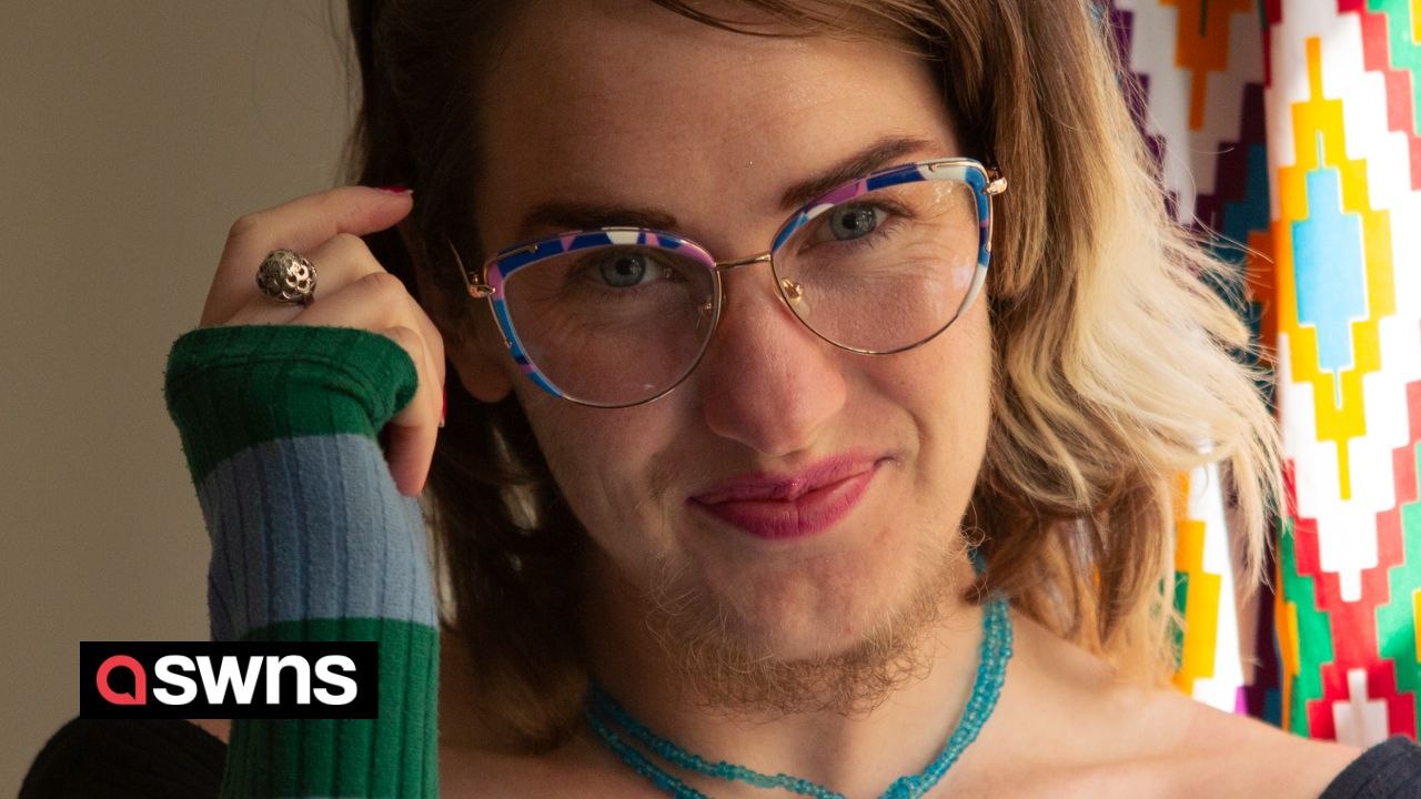 Woman who spent £51k removing body hair finally embraces it - "despite being mistaken for a man"