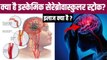 Ischemic Cerebrovascular Stroke Kya Hota Hai, Causes, Symptoms & Treatment In Hindi | Boldsky