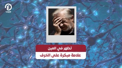 تظهر في العين.. علامة مبكرة على الخرف