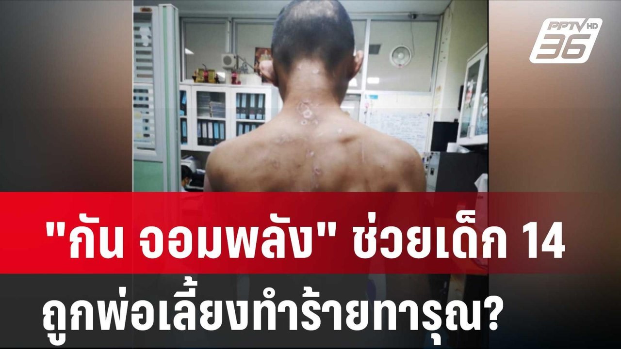 "กัน จอมพลัง" ช่วยเด็ก 14 ถูกพ่อเลี้ยงทำร้ายทาร...