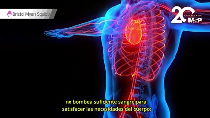 ¿Qué es la cardiomiopatía y cómo afecta a tu corazón? 🫀