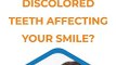 Teeth Whitening Treatment | Cosmetic Dentistry | Family Dental Simi Valley