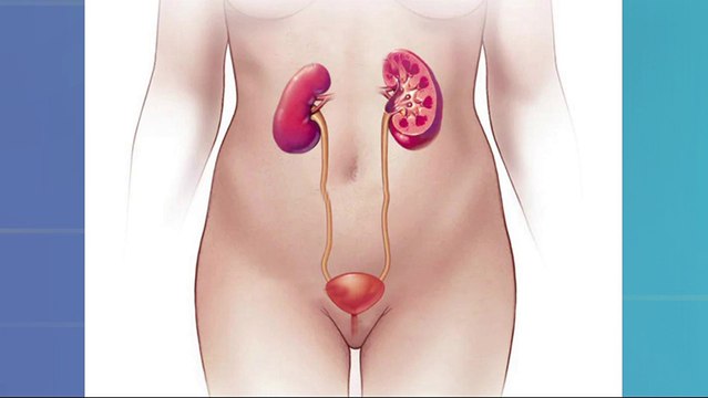 bd-infecciones-urinarias-y-sus-riesgos-150224