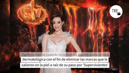 Las impactantes imágenes de las quemaduras de Adara Molinero tras eliminar las manchas de 'Supervivientes'e