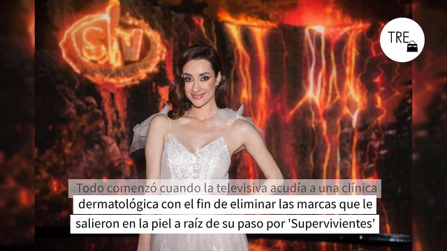 Las impactantes imágenes de las quemaduras de Adara Molinero tras eliminar las manchas de 'Supervivientes'e