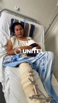 Me iba a levantar pero no sentía mis piernas : el testimonio de la joven atropellada por un trufi y quedó con fracturas en la pierna