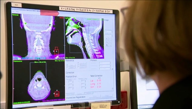 Study finds three more cancers linked to inactivity