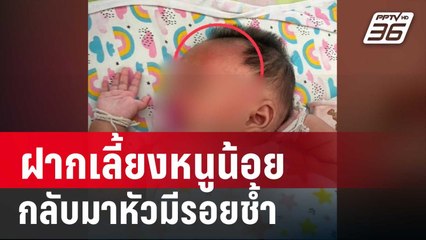 ญาติร้องฝากเลี้ยงหนูน้อยวัย 2 เดือน กลับมาหัวมีรอยช้ำ | เข้มข่าวค่ำ | 16 ก.พ. 67