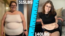 I've Been Left With 10lbs Of Excess Skin | BRAND NEW ME