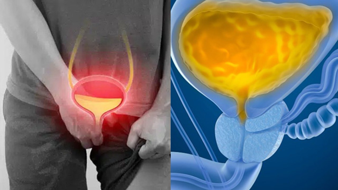 Urinary Bladder Ka Size Kitna Hona Chahiye | Normal Size Bladder | Boldsky