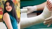 Dangal Girl Suhani Bhatnagar Demise Reason, Medicine Side Effect Symptoms In Hindi | Boldsky