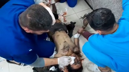 شاهد.. وصول طفل مصاب بإصابات خطيرة إلى مستشفى أبو يوسف النجار