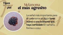 Tipos de cáncer de piel